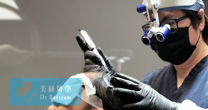 Painless SMP hair tattoo in an aseptic environment